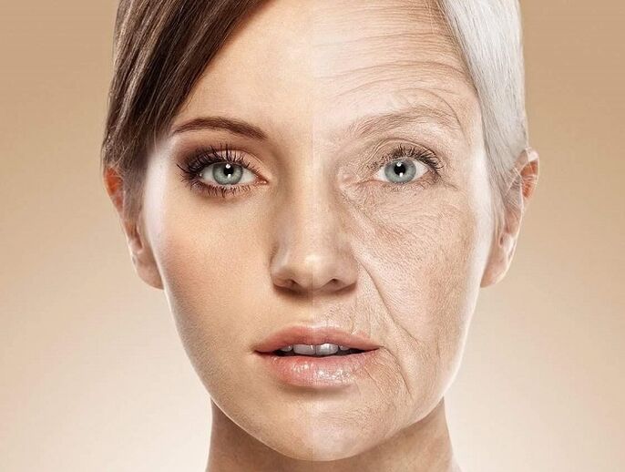 kasvojen iho ennen laser nuorentamista ja sen jälkeen